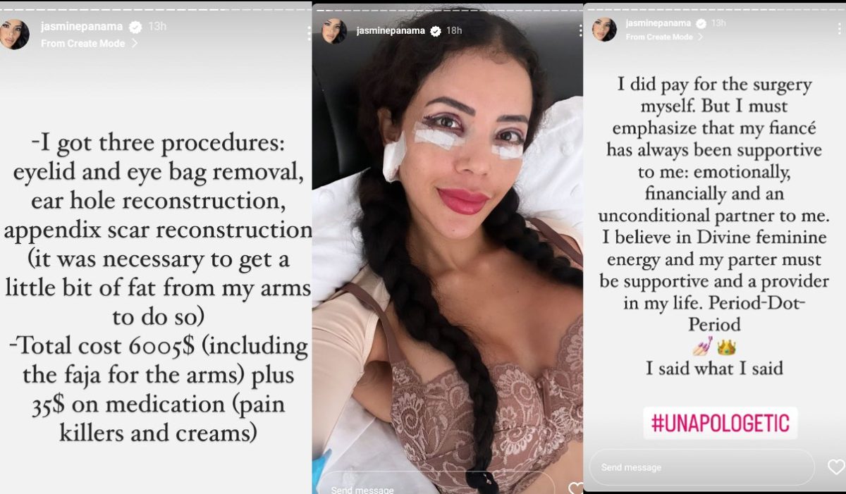 90 Day Fiance Did Gino Palazzolo Pay For Jasmine Pinedas New Surgeries 