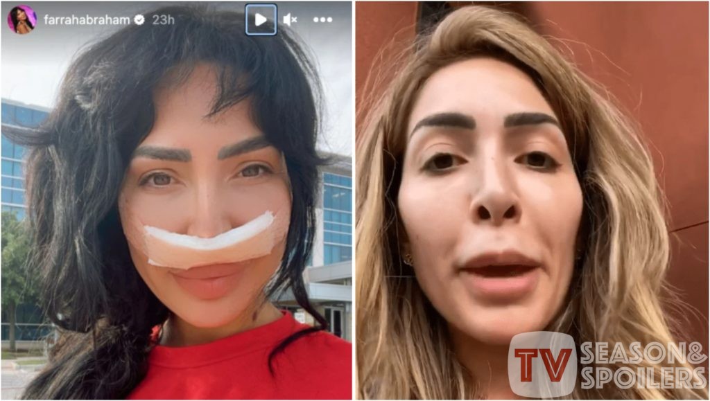 Teen Mom Fans Get Scared To See Farrah Abrahams Face Covered With Bandages What Happened To Her 